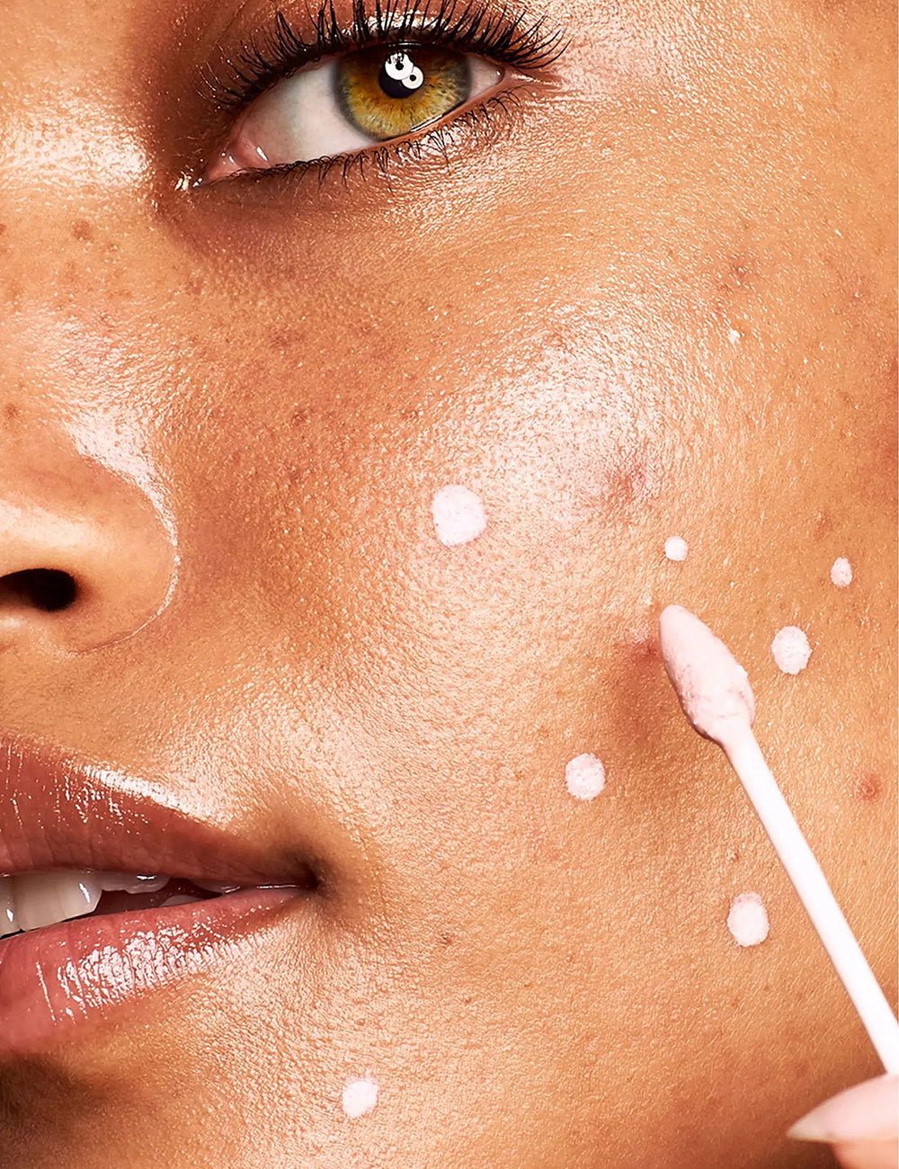 Benzoyl Peroxide Face Wash